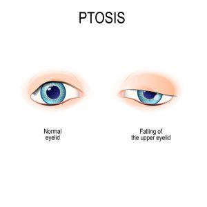 What Types of Surgeries Does an Oculoplastic Surgeon Perform