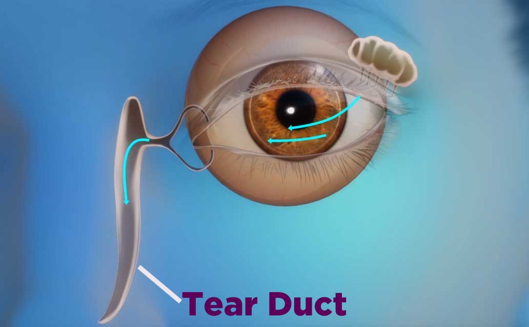 clogged tear duct remedies